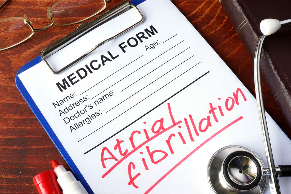 Top 4 Ways to Prevent Atrial Fibrilation
