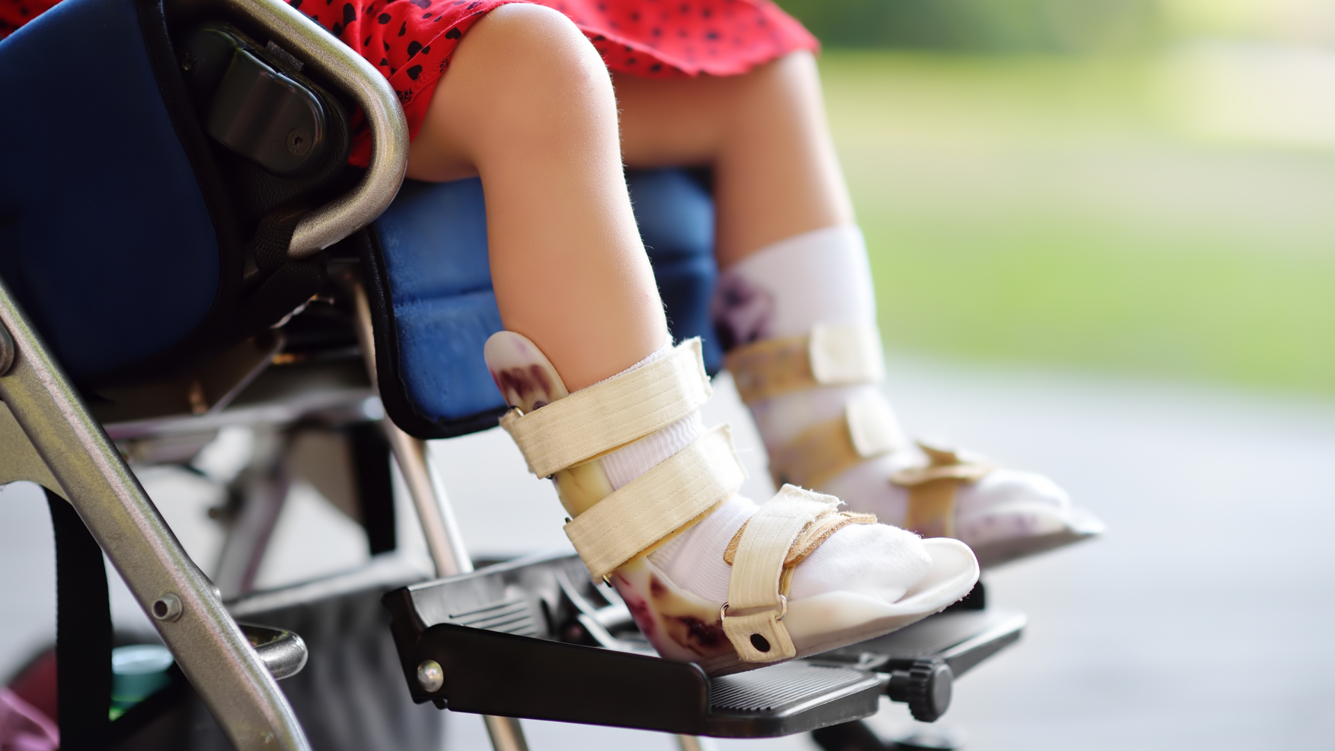 How Spinal Muscular Atrophy Affects Children