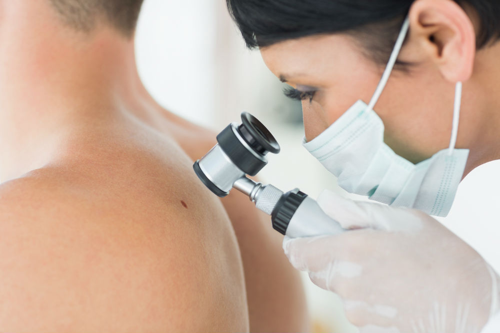 Top 4 Treatments for Melanoma Cancer