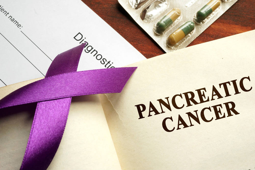 Top 4 Treatment Options for Pancreatic Cancer