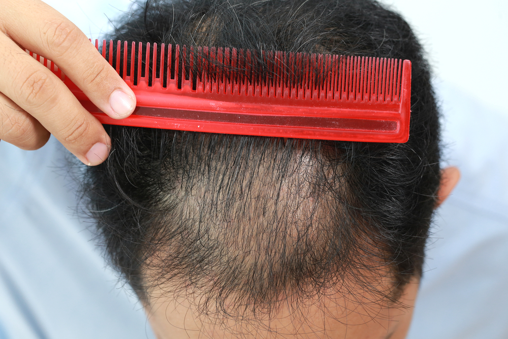 Best Products for Thinning Hair