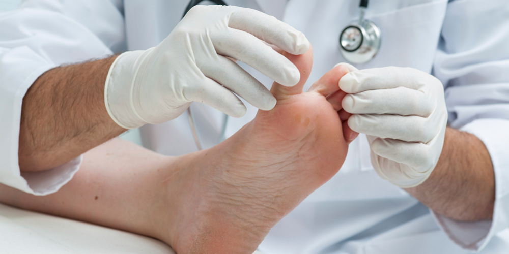 Top 4 Options for Treating Diabetic Foot Ulcers  